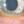 Figure. Conjunctivochalasis demonstrated by redundant bulbar conjunctival tissue along the lower eyelid margin.