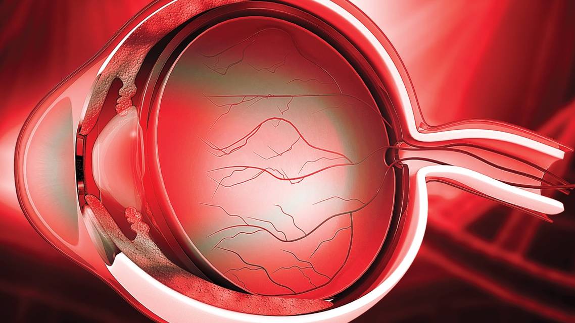 Understanding the Neurobiology and Pain Pathways of DED