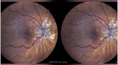 GA Case Compendium Collaborative Care to Improve Patient Adherence to Therapy