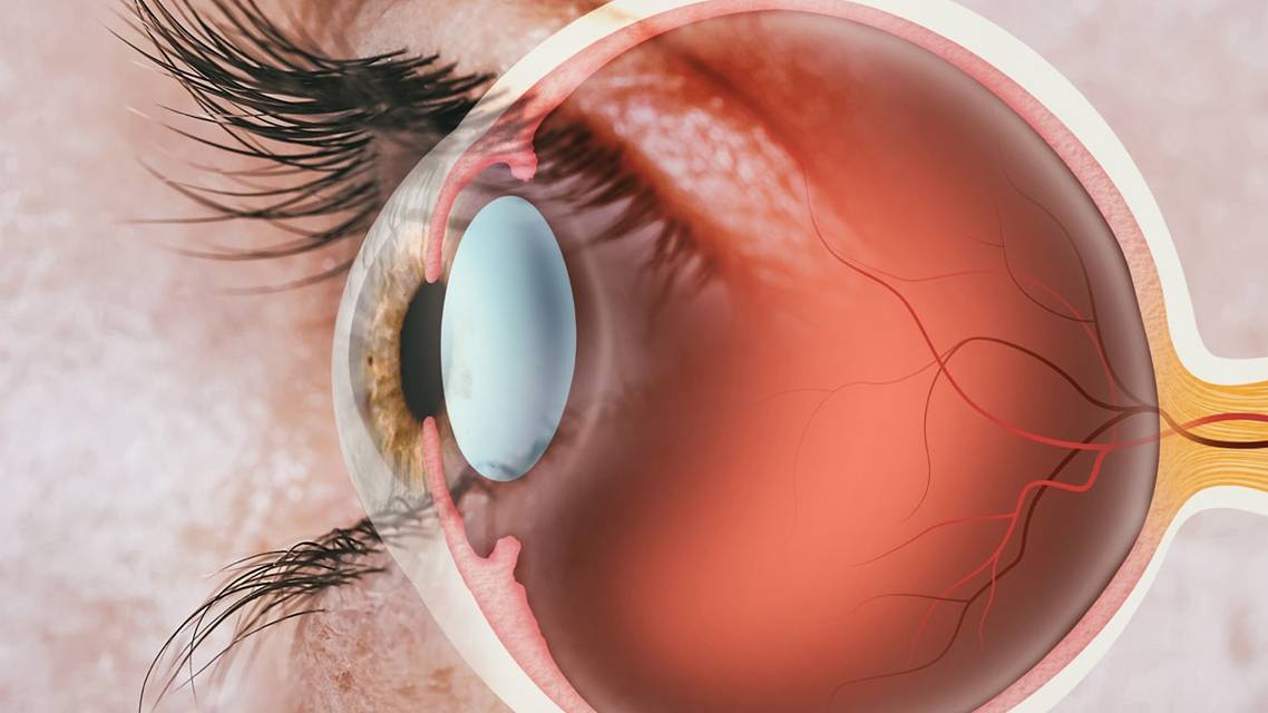 Clinical Tips to Perform Effective Scleral Indentation