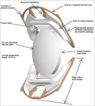 CORD Files for Premarket Approval with the FDA for the SC9 IOL for Cataract Surgery image