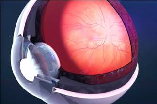 AGTC Presents Data from Ongoing Phase 1/2 Trial of AGTC-501 at American Academy of Ophthalmology 2021 Annual Meeting image