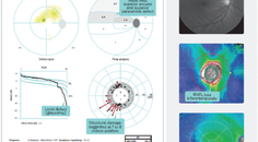 Structure and Function in Early Glaucoma Diagnosis