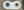 Figure 1. Note the custom-tinted prosthetic lens on the left and the other with the pigmented iris area.