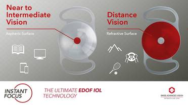 SAV-IOL Launches Instant Focus EDOF IOL Technology image