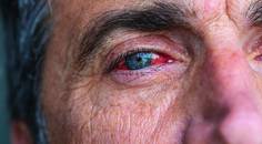 One More Issue if You Please