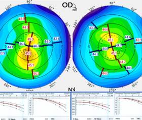 Collaborative Case Reports - Modern Optometry