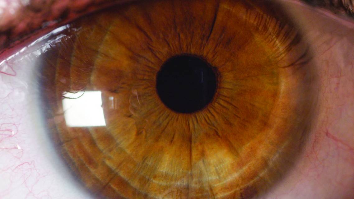 Five Rules of Thumb for Managing the Ocular Surface