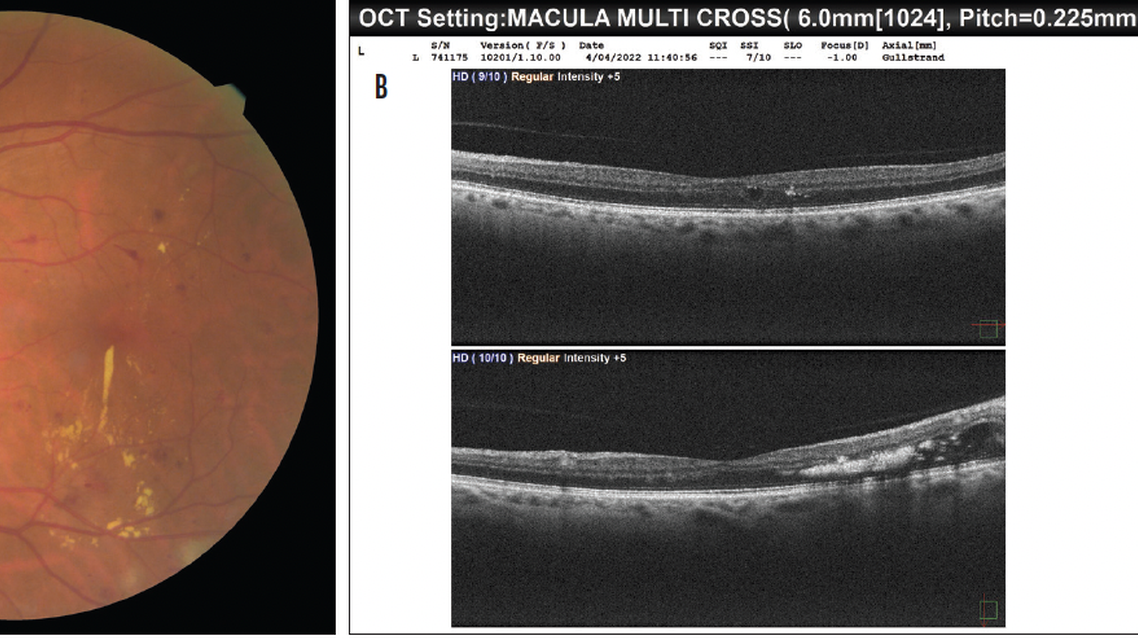 Making the Most of OCT Imaging