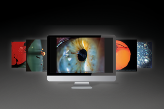 Haag-Streit to Host 4th Annuel ‘Slit Lamp Imaging Competition’ image