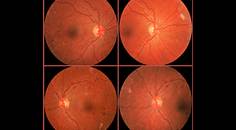 Collaborative Case 003 What Matters and What Doesnt