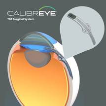 Myra Vision Secures FDA Approval to Initiate US-Based IDE Study in Glaucoma image