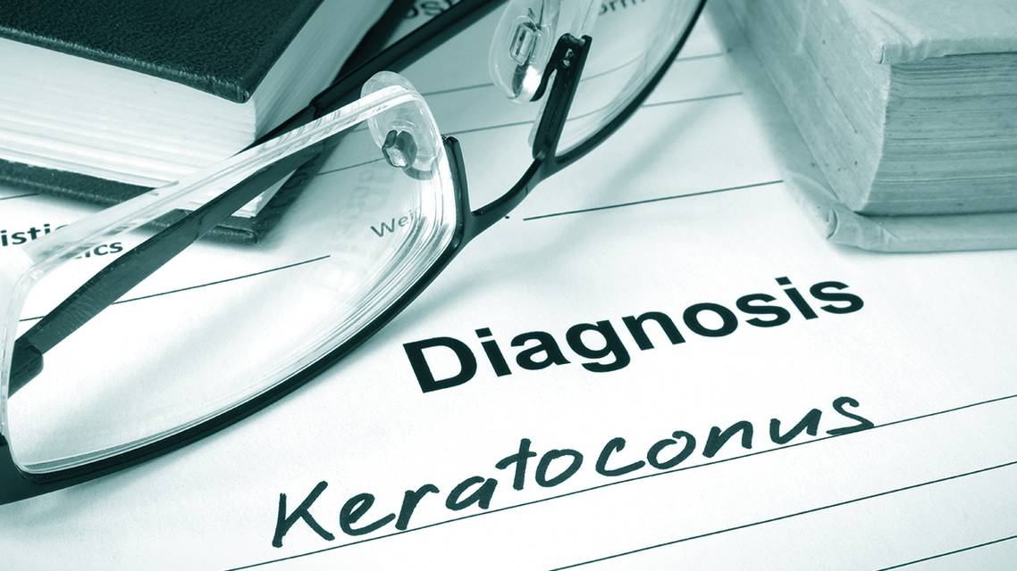Update on Keratoconus Treatment