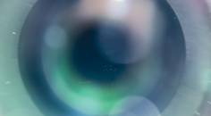 Is Orthokeratology a Dying Art