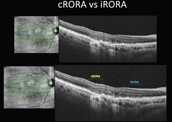 Retina in Review
