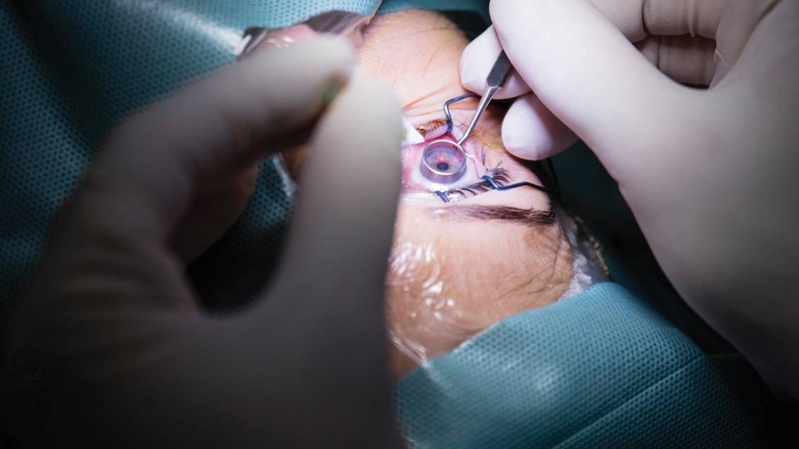 Epi Off Versus Epi On the Conversation Continues