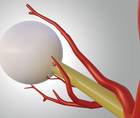 The Mystery of Cilioretinal Arteries and AMD