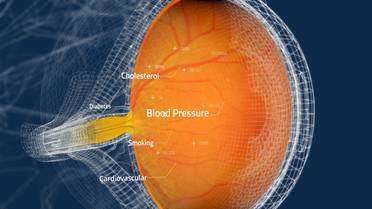 Toku Obtains CE and UKCA Marks for AI Cardiovascular Risk Assessments Through the Eye image