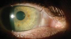 Diagnostics for the Right Fit