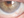 Figure 2. Slit-lamp photography of the left eye, 3 months after SLET.