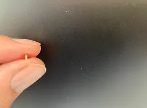 Injectsense Completes First Successful Human Implant of Ultraminiature Intraocular Pressure Sensor image