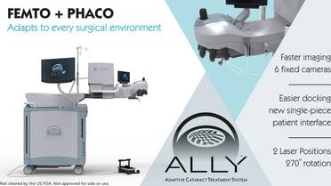 Lensar Announces FDA of 510(k) Submission for ALLY image