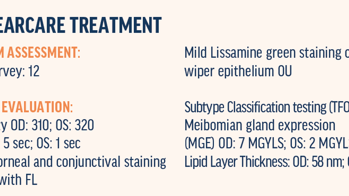 Why Dry Eye Let Me Count The Whys