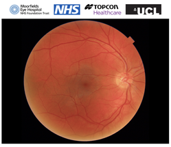 Moorfields Eye Hospital, UCL Institute of Ophthalmology and Topcon Partner to Launch New Medical Technology Company image
