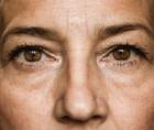 Ocular Surface Dryness in Women