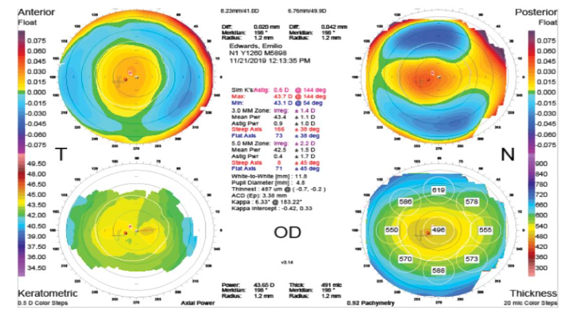 AvaGen The Genetic Eye Test in Modern Practice