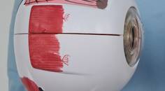 The Role of Nutrition in Glaucoma Care