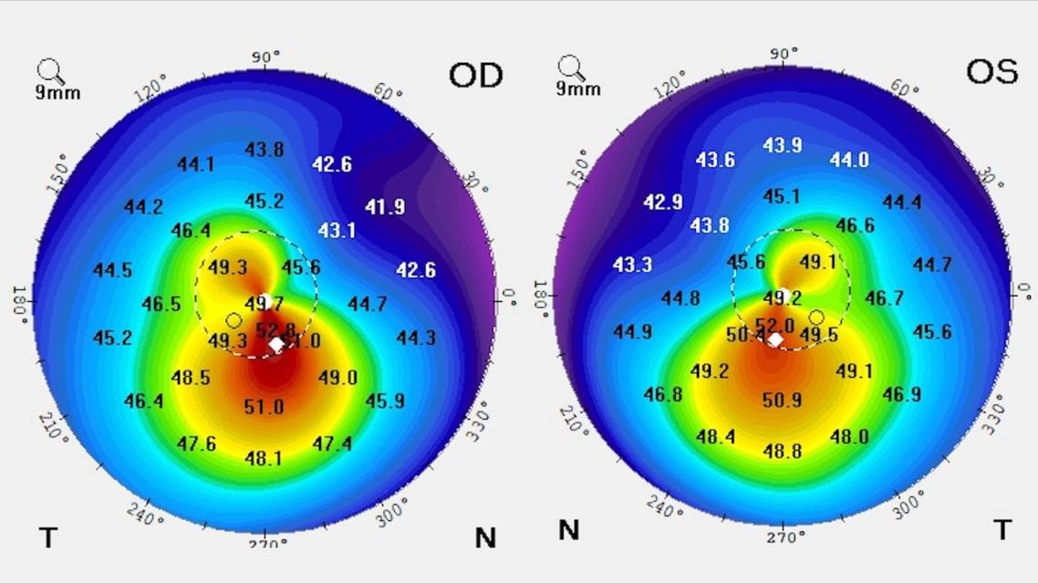 Collaborative Case 001 To Treat or Not to Treat