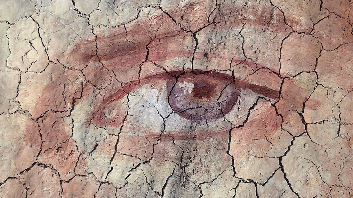 Essentials for Diagnosing OSD