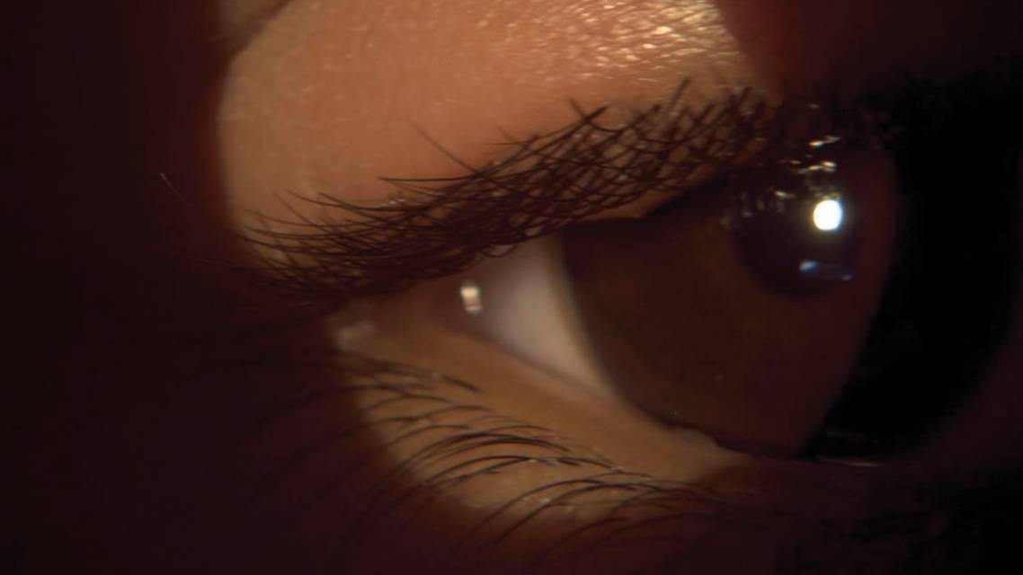 Understanding Photobiomodulation Therapy