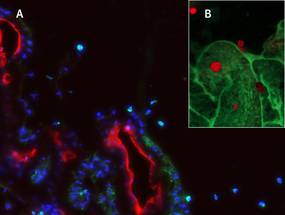 Novel Imaging Technology Reveals Role of Immune Cells in Early Diabetic Cataract Development image
