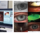 Dry Eye Story Maximizing Workflow Implementing Advanced Technologies Finding Fulfillment