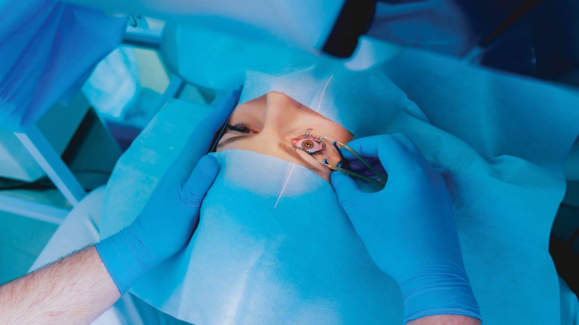 refractive surgery
