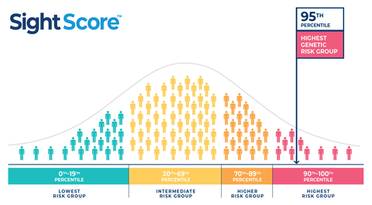 Seonix Bio Launches SightScore, the First Clinical Polygenic Risk Score Test for Glaucoma in the US image