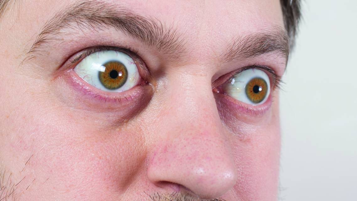 What You Need to Know to Manage TED