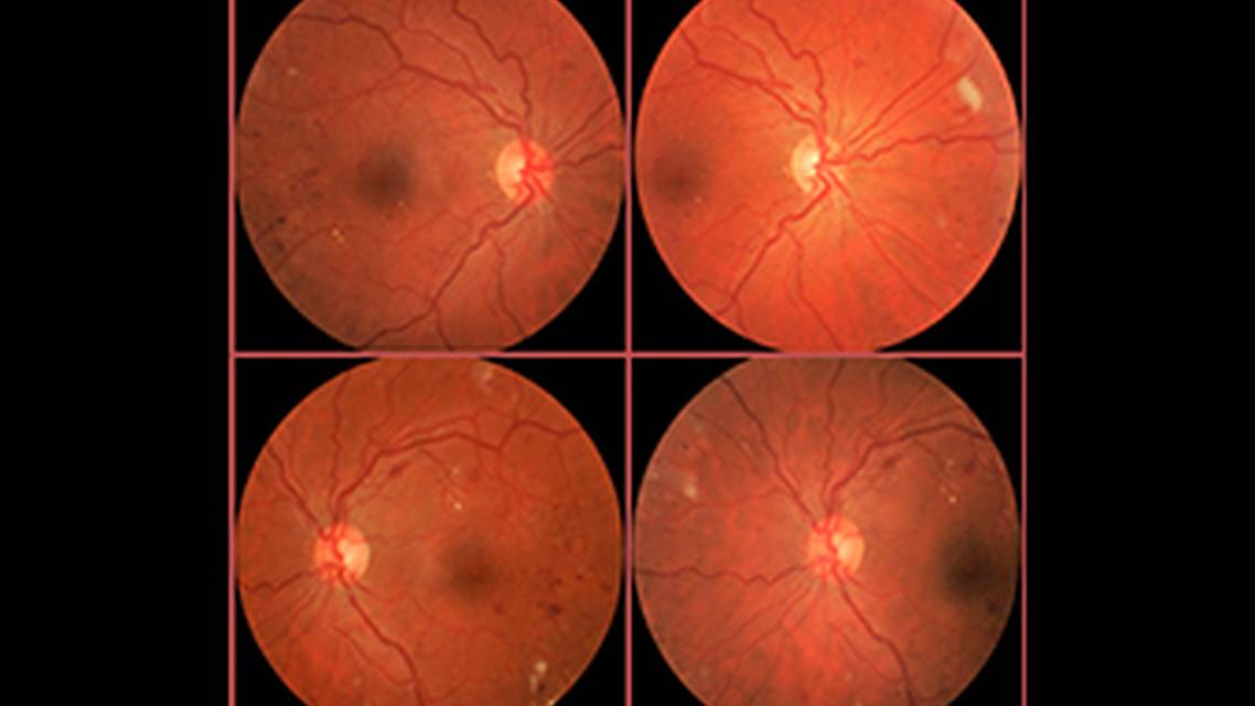 Collaborative Case 003 What Matters and What Doesnt