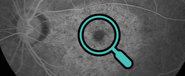 Eye2Gene and Heidelberg Engineering Announce Partnership at ARVO 2024 image