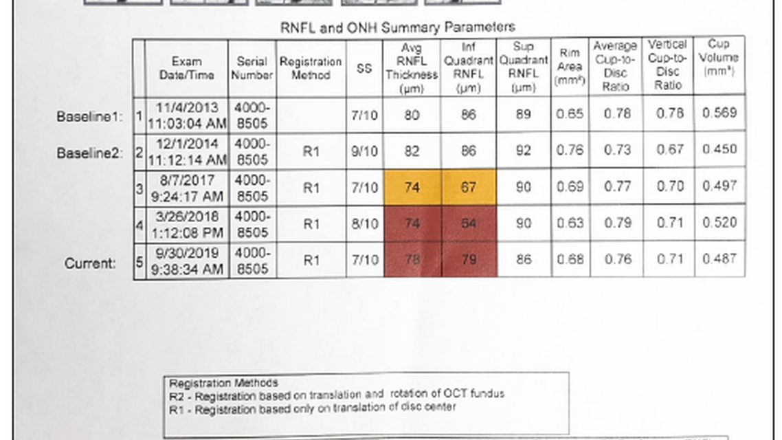 New Pharmacotherapeutics for the Treatment of Glaucoma Targeting the Trabecular Meshwork