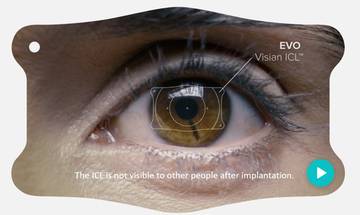 Staar Surgical Announces FDA Approval of EVO Visian Implantable Collamer Lenses image