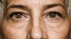 Ocular Surface Dryness in Women