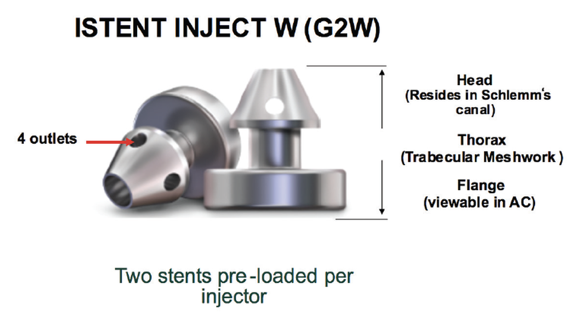 Five Things Every OD Should Know About Trabecular Meshwork Bypass and MIGS