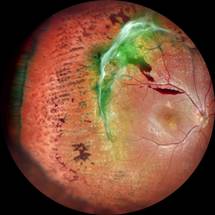 Nidek Announces Winners of the 4th Annual Image of the Year Award image