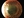 Figure. Indirect illumination shows a Khodadoust line, a linear pattern of keratic precipitates within the endothelium of a corneal graft, in a patient who underwent a penetrating keratoplasty. Figure