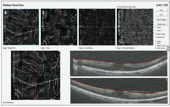 A New Ally in the Diagnosis and Management of Diabetic...