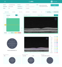 Altris Launches New Artificial Intelligence Platform for Automated OCT Scans image