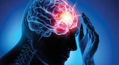 Managing Patients With Concussion